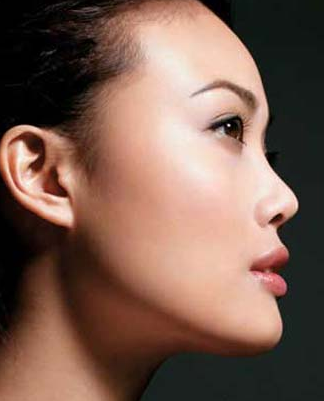 丰耳垂手术 让您美丽更完美