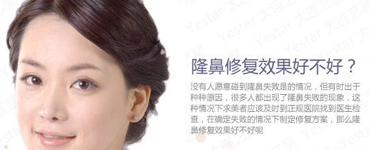 隆鼻修复效果好不好